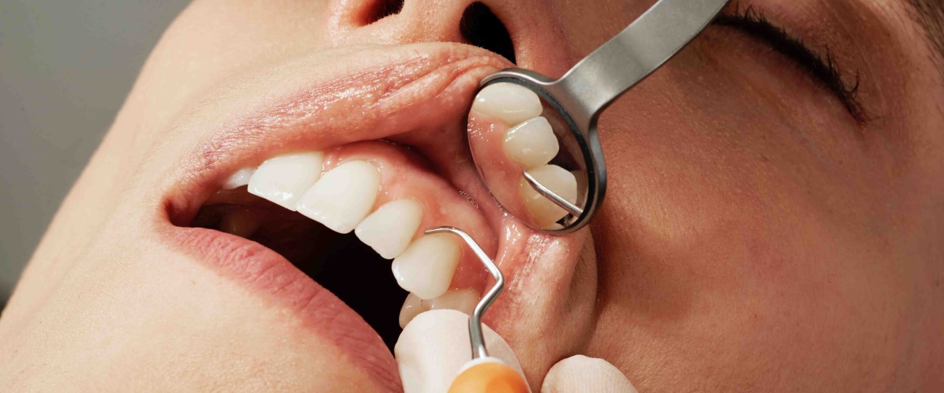 What are common dental procedures?
