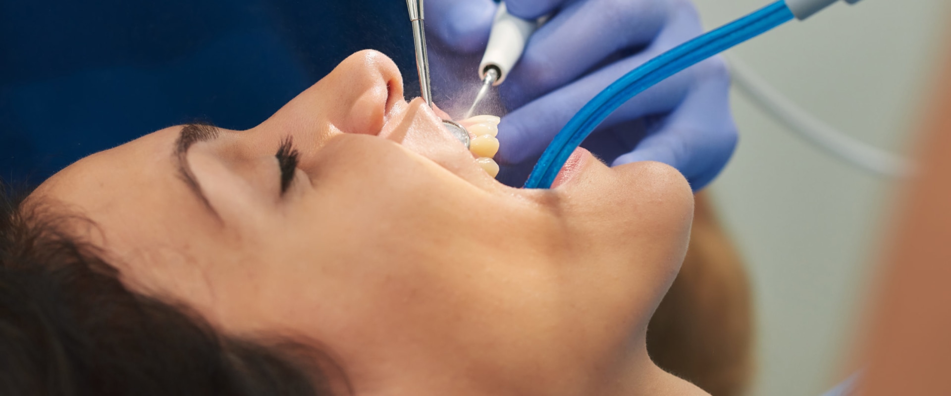 What is the most common dental procedure?