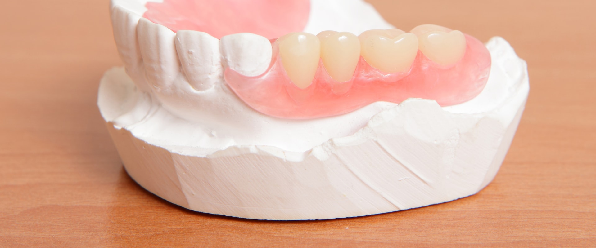 Can children get dentures?