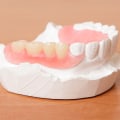Can children get dentures?